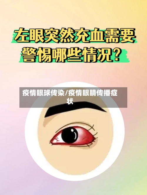 疫情眼球传染/疫情眼睛传播症状