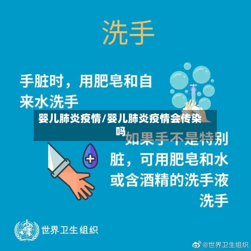 婴儿肺炎疫情/婴儿肺炎疫情会传染吗