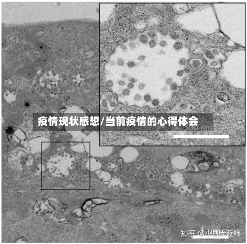 疫情现状感想/当前疫情的心得体会