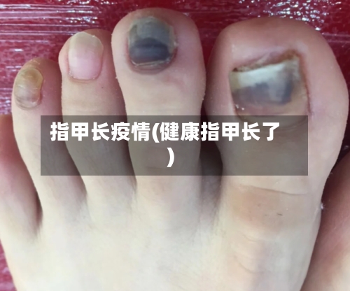 指甲长疫情(健康指甲长了)